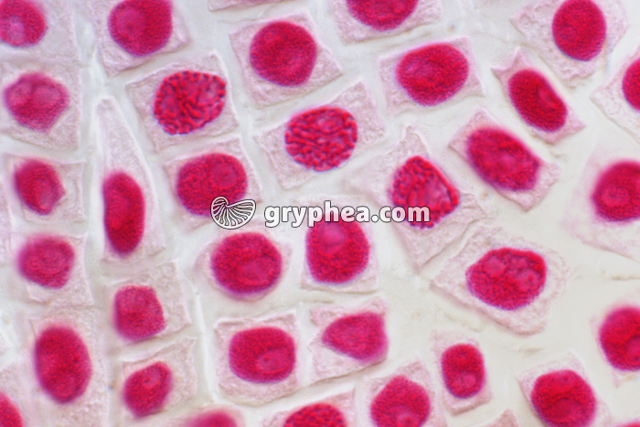 Mitoses de cellules de racine d'Ail - vue 2 - coloration Feulgen x160 - gryphea.org